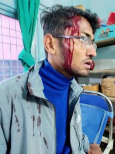 photo20220228kanchanpur (2)