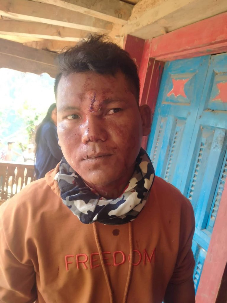 Photo Dolpa_2022-05-06