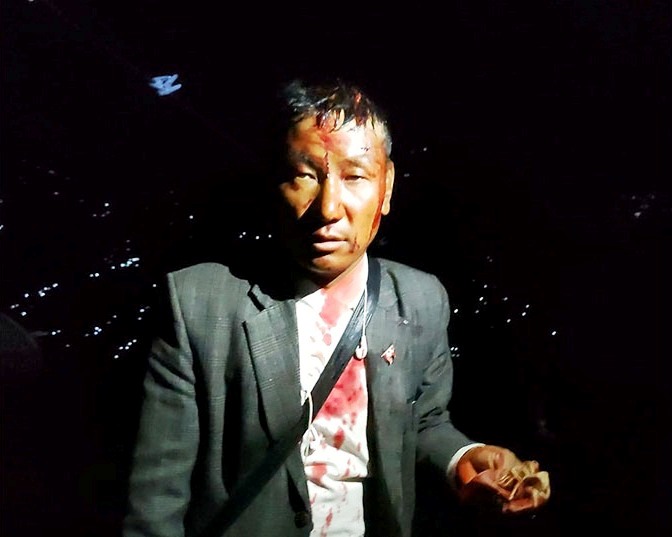 Ramesh sunuar
