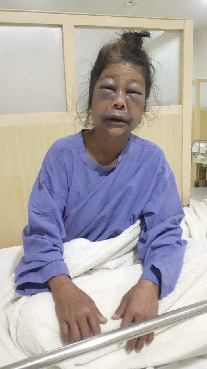 photo 2023327 dhankuta (2)